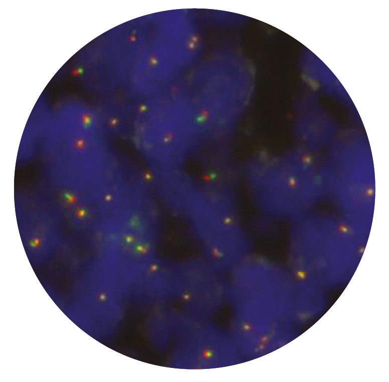 Fluorescence in situ hybridisation (FISH) microscope image of the CytoCell FUS Breakapart probe.
