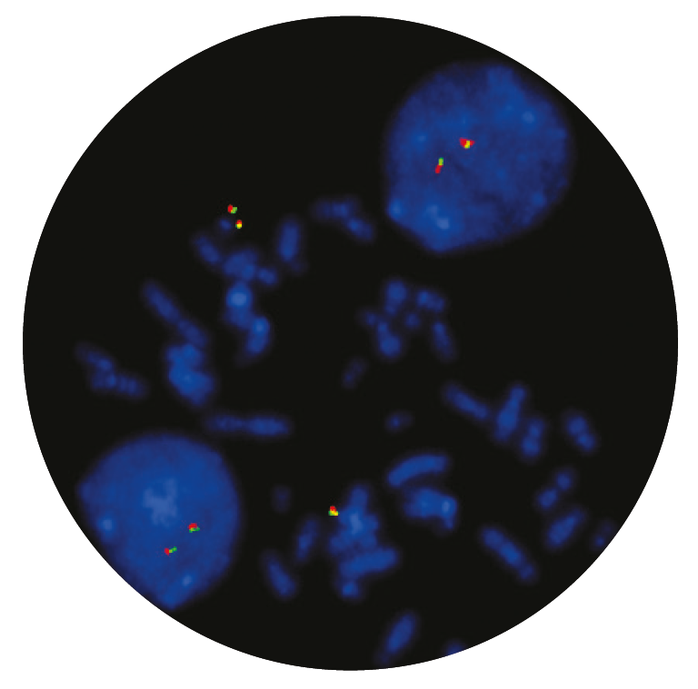 Fluorescence in situ hybridisation (FISH) microscope image of the CytoCell MLL (KMT2A) Breakapart probe.