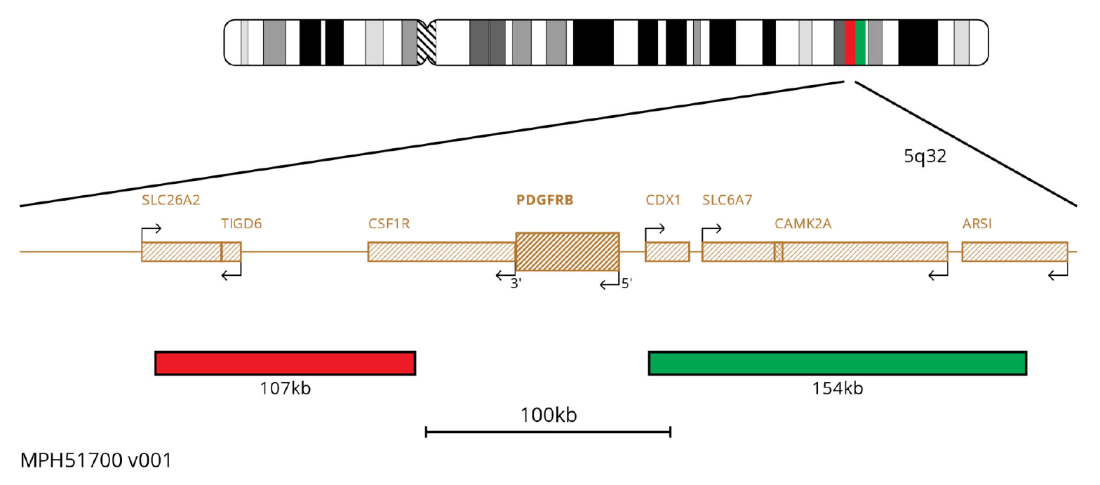 Fluorescence in situ hybridisation (FISH) chromosome map showing probes targeting the PDGFRB and CSF1R genes.