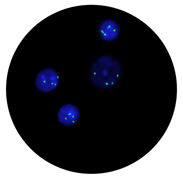Fluorescence in situ hybridisation (FISH) microscope image of the CytoCell Prenatal X, Y, 13, 18 and 21 probe.