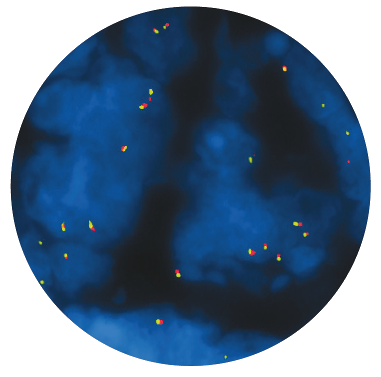 Fluorescence in situ hybridisation (FISH) microscope image of the CytoCell PAX7 Breakapart probe.