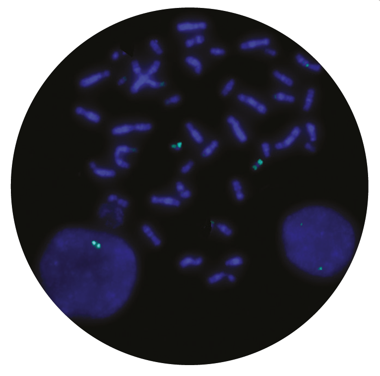 Fluorescence in situ hybridization (FISH) microscope image of the CytoCell HLF probe.
