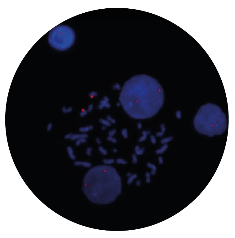 Fluorescence in situ hybridization (FISH) microscope image of the CytoCell ETV6 Distal Probe Red.
