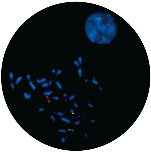 Fluorescence in situ hybridisation (FISH) microscope image of the CytoCell IGH/MAFB Translocation, Dual Fusion probe.