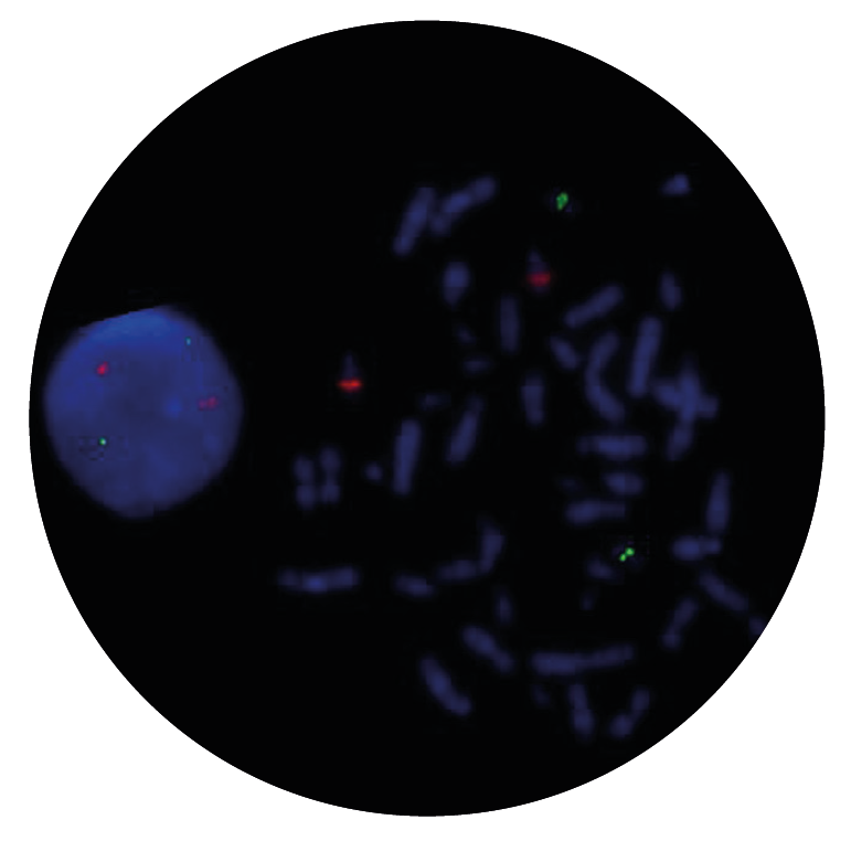 Fluorescence in situ hybridisation (FISH) microscope image of the CytoCell FAST PML/RARA Translocation, Dual Fusion probe.