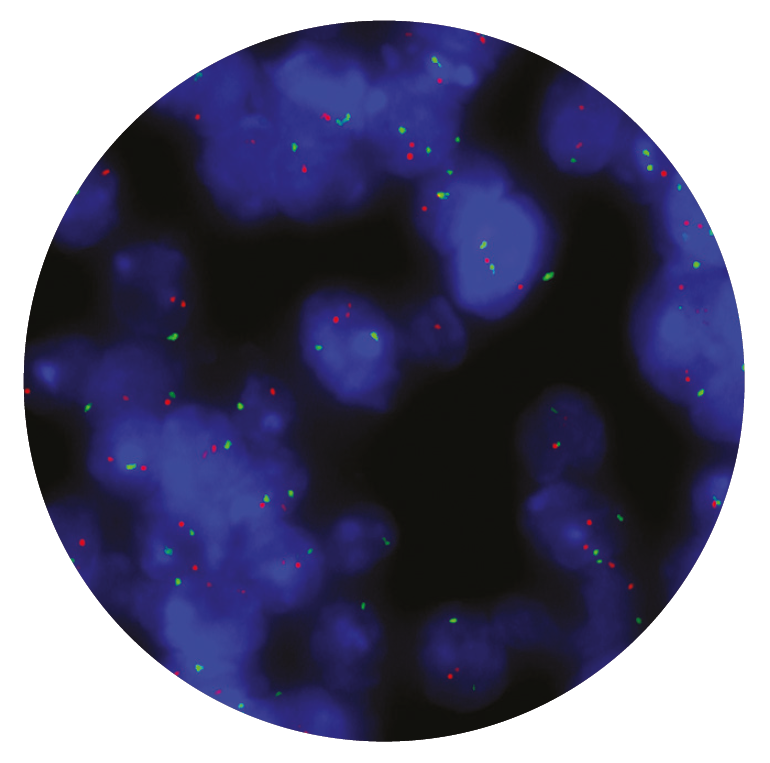 Fluorescence in situ hybridisation (FISH) microscope image of the CytoCell TOP2A Amplification/Deletion probe.