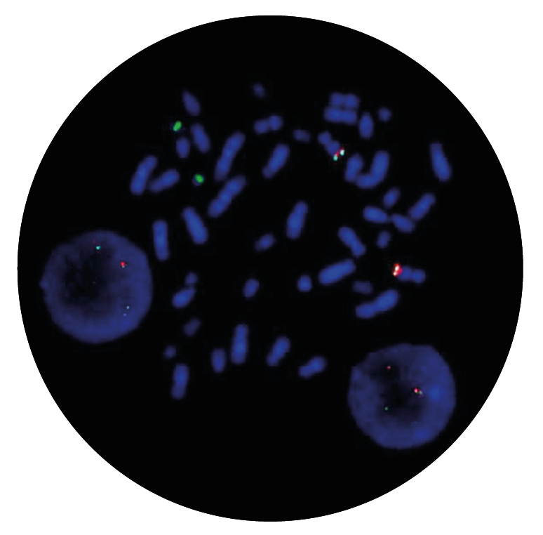Fluorescence in situ hybridisation (FISH) microscope image of the CytoCell BCR/ABL Plus Translocation, Dual Fusion probe.