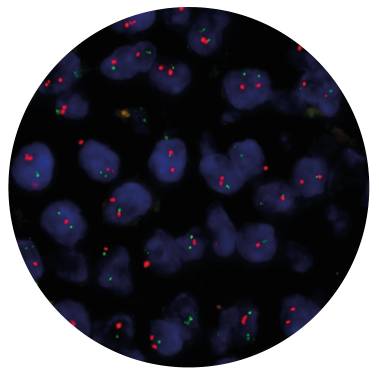 Fluorescence in situ hybridization (FISH) microscope image of the CytoCell IGH/CCND1 Translocation, Dual Fusion probe.