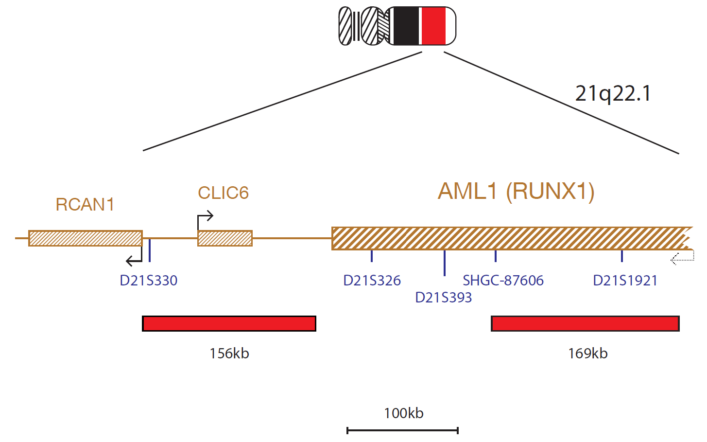 Fluorescence in situ hybridization (FISH) chromosome map showing a probe mix targeting the AML (RUNX1) gene.
