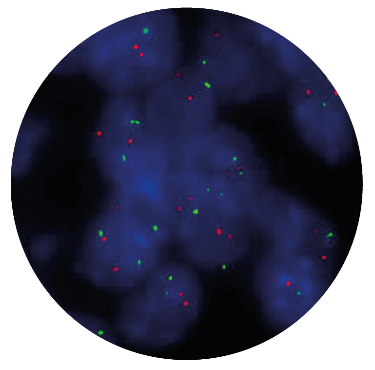 Fluorescence in situ hybridisation (FISH) microscope image of the CytoCell P53 (TP53) Deletion probe.