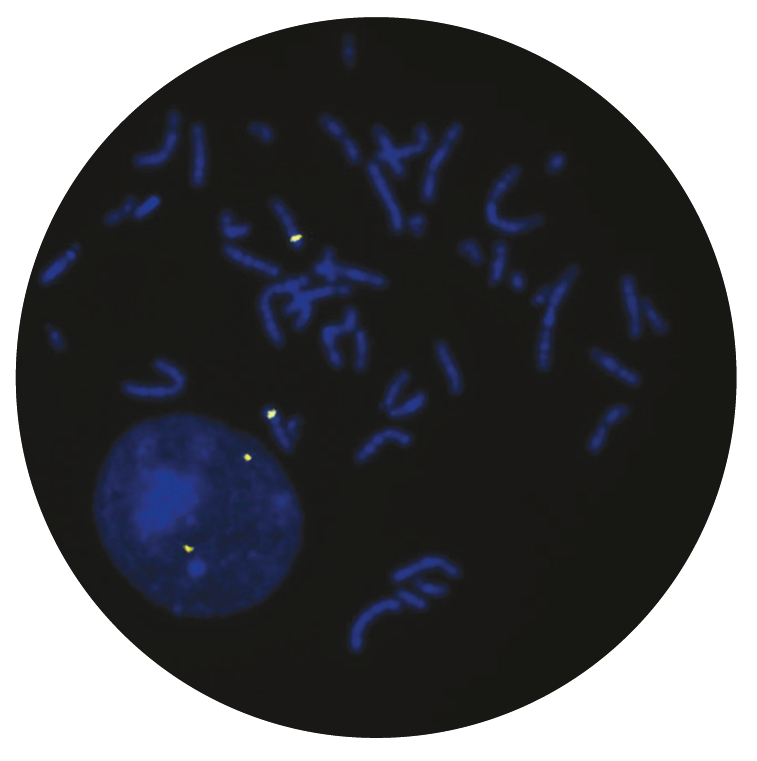 Fluorescence in situ hybridization (FISH) microscope image of the CytoCell CDKN2A Probe Gold.