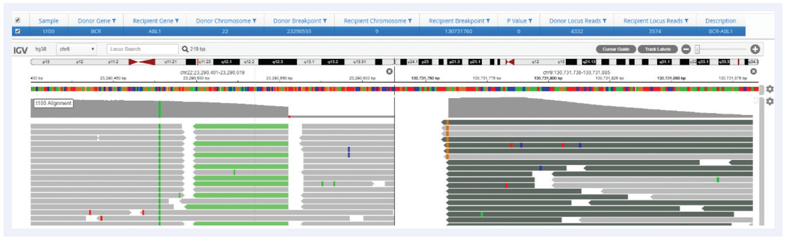 Next generation sequencing (NGS) software data showing a BCR-ABL translocation.