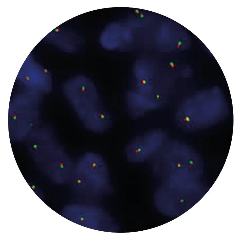Fluorescence in situ hybridisation (FISH) microscope image of the CytoCell EML4 Breakapart probe.
