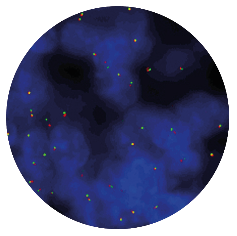 Fluorescence in situ hybridisation (FISH) microscope image of the CytoCell MYC Breakapart probe.